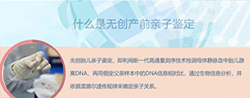 扬州怀孕了怎么做亲子鉴定最简单方便,扬州孕期亲子鉴定收费多少钱 扬州怀孕了怎么做亲子鉴定最简单方便,扬州孕期亲子鉴定收费多少钱